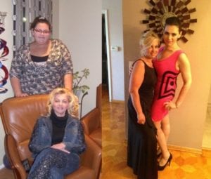 Lap Band Before And After Weight Loss Surgery Mother and Daughter Weight Loss Surgery Center Of Los Angeles