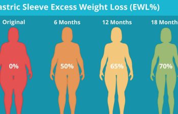 Gatrsic Sleeve Excess Weight Loss (EWL%)Chart