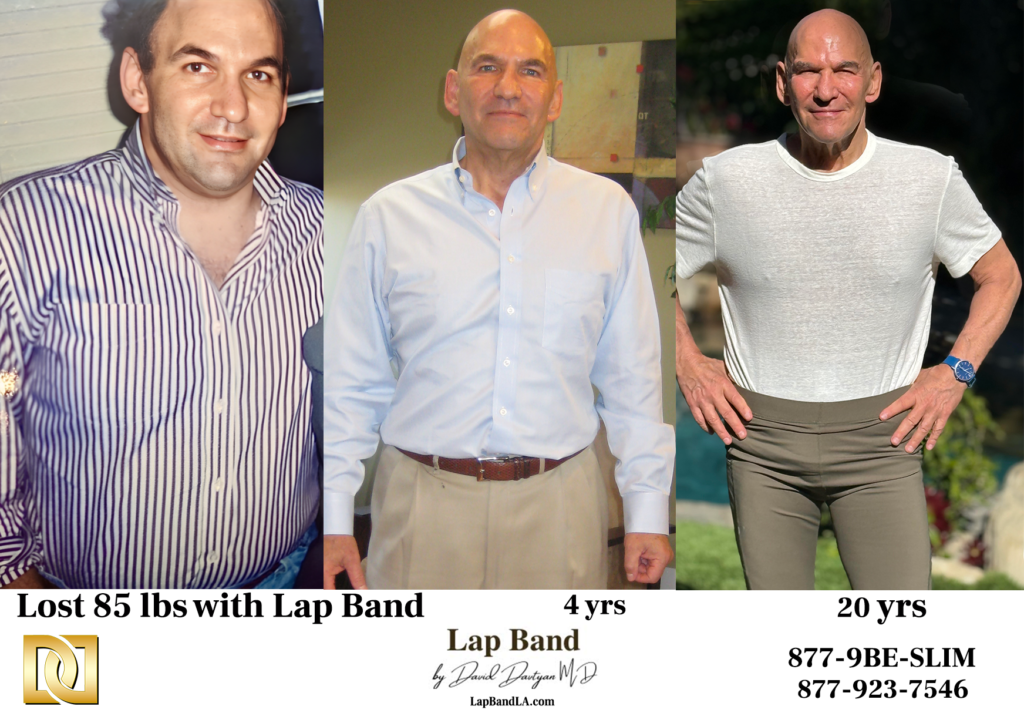 Before and After Lap-Band Surgery: weight loss success photos of Jeff W. 4 years and 20 years later