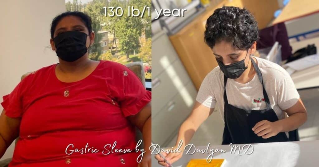 Cirugía bariátrica antes y después de Jesicca Martinez