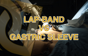 Lap-Band vs Gastric Sleeve