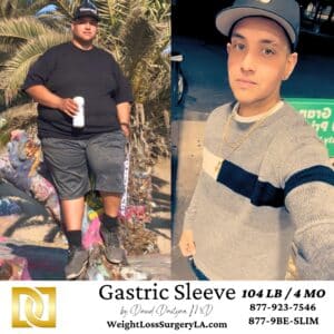 Gastric Sleeve patient Before and After Photos, Walter Sanchez 